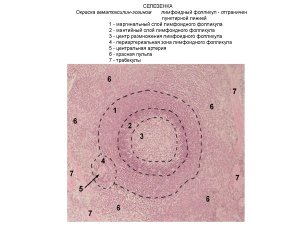 Селезенка человека окраска гематоксилином и эозином