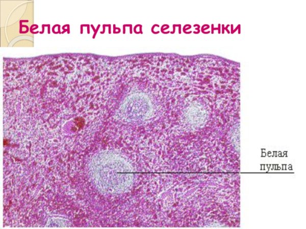 Белая и красная пульпа селезёнки препарат гистология