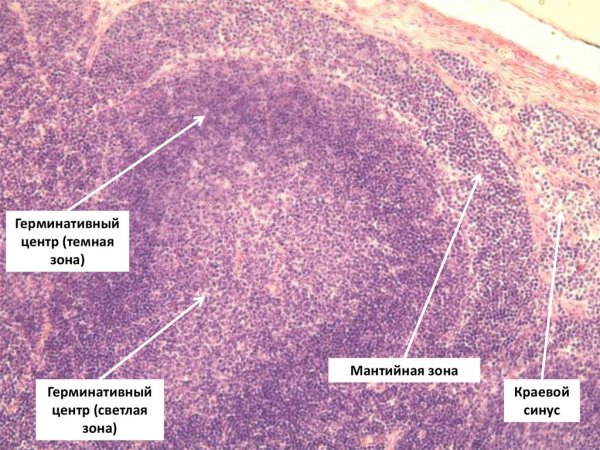 Мантийная зона лимфоузла