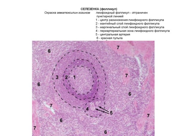 Селезенка окраска гематоксилин-эозином
