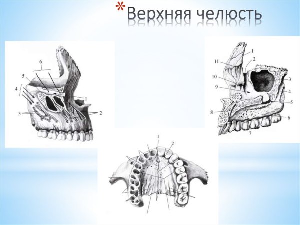 Верхняя челюсть (Maxilla)