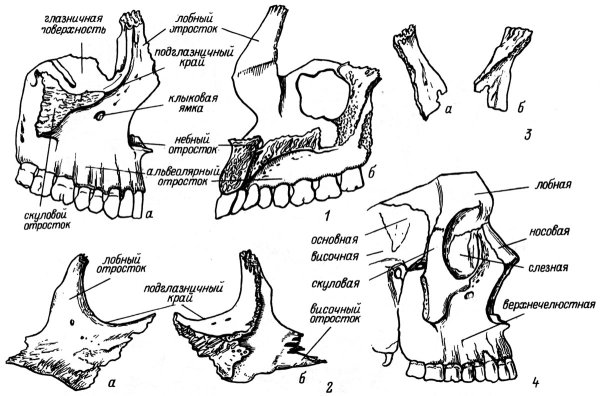 Анатомия верхнечелюстной кости