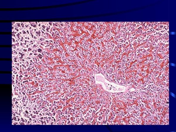 Микроперипарат мускатни печен