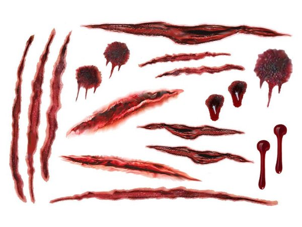 Травмы картина для детей