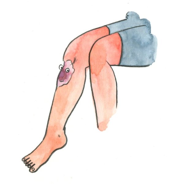 Травма рисунок