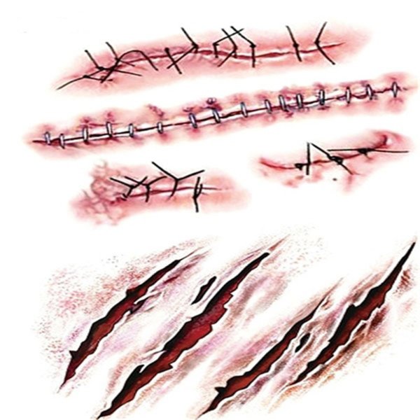 Перевязывание рана на руке