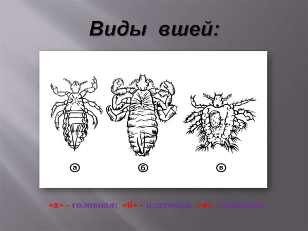 Головная вошь классификация