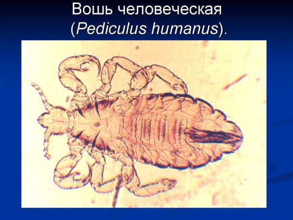 Pediculus humanus humanus самец