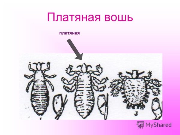 Платяная вошь строение самки