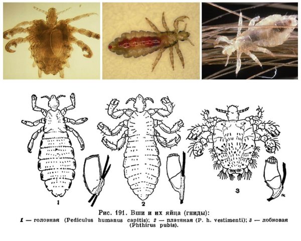 Платяная вошь строение