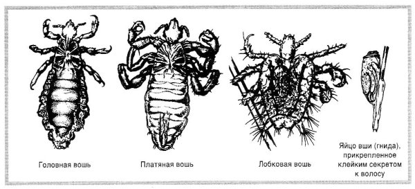 Головная вошь - Pediculus capitis