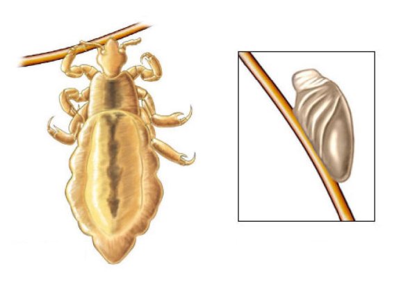 Головная вошь самка строение