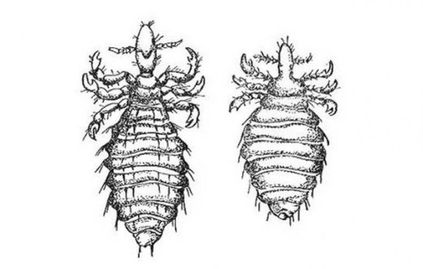 Головная вошь самка строение