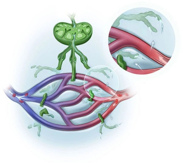 Исследование лимфатической системы