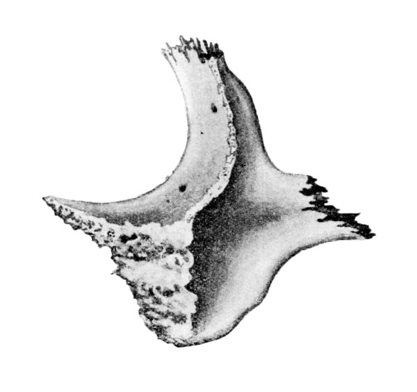 Скуловая кость кость анатомия