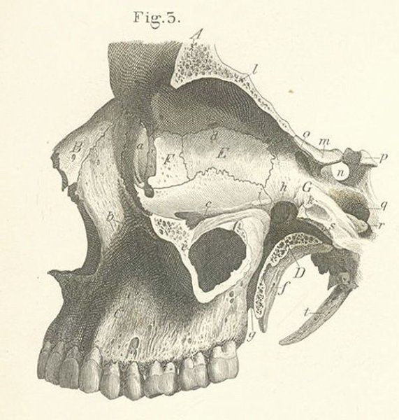 Скуловая кость вид снаружи и изнутри