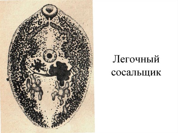 Легочный сосальщик парагонимоз