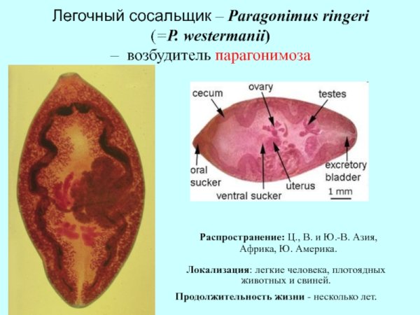 Трематод Paragonimus westermani