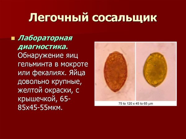 Paragonimus westermani инвазионная стадия