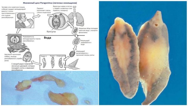 Строение яйца легочного сосальщика