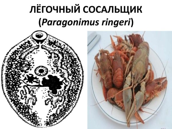 Лёгочный сосальщик паразит