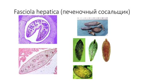 Строение половой системы фасциолы