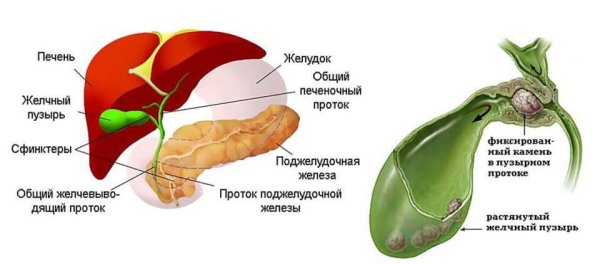 Дискинезия жёлчного пузыря и желчевыводящих путей