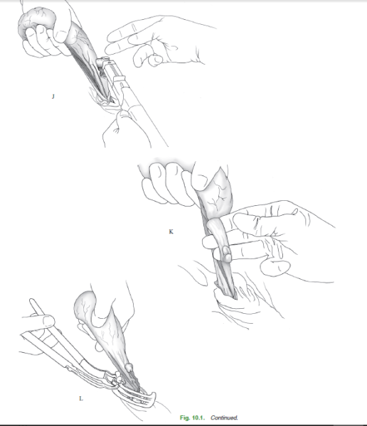 Аниме боллбастинг Манга