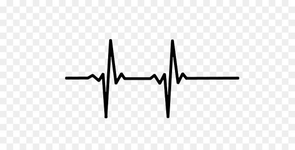 Сердцебиение кардиограмма
