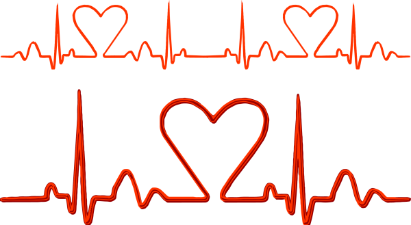 Кардиограмма сердца