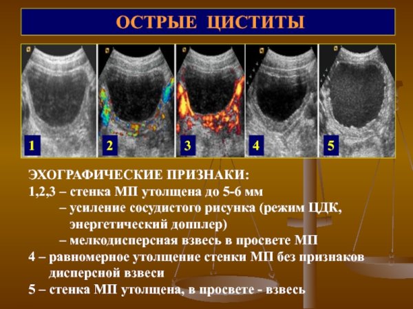 Легочный рисунок
