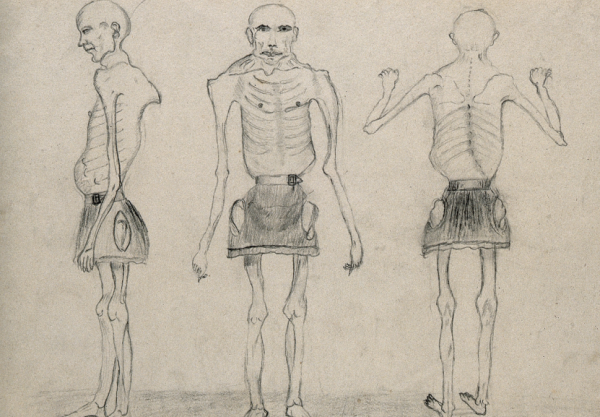 Исаак Спрэг человек скелет