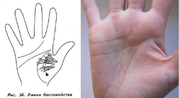 Линии лекаря на руке