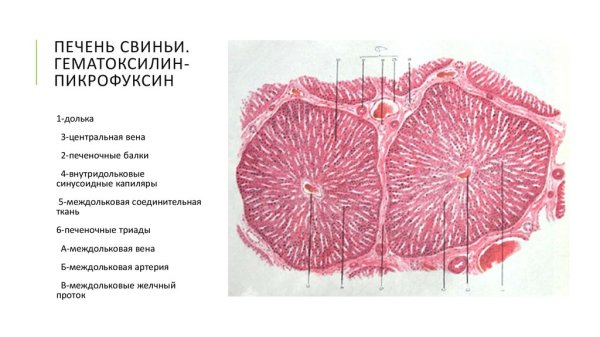 Печень свиньи гистология препарат