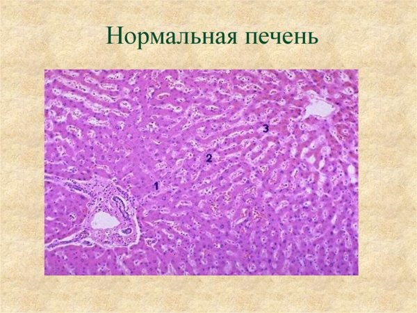 Строение печени гистология микропрепарат