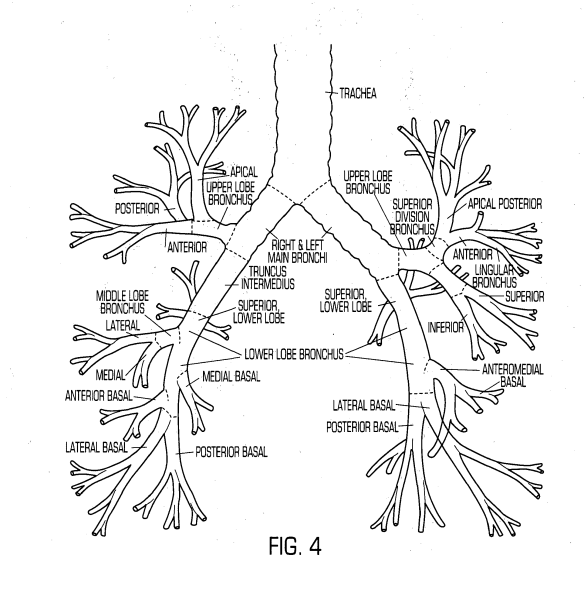 Анатомия трахеобронхиального дерева схема