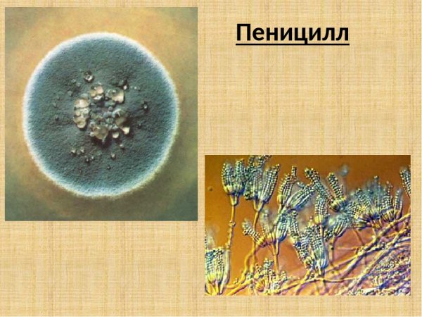 Строение плесени мукора