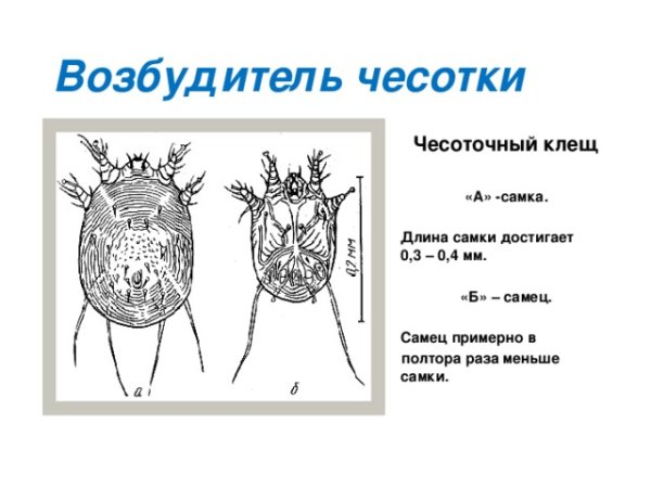 Клещ чесоточный зудень строение