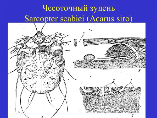 Чесоточный зудень жизненный цикл