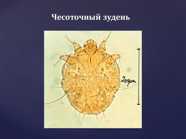 Чесоточный зудень морфология