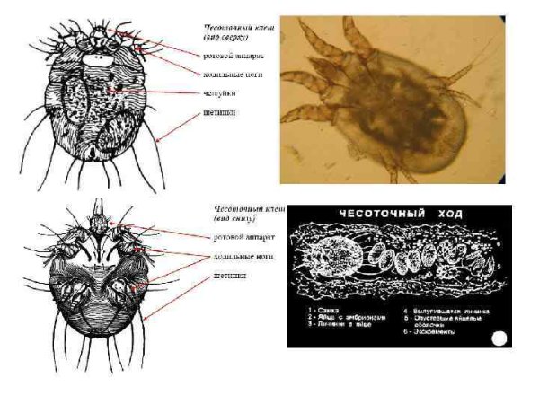 Чесоточный зудень микропрепарат