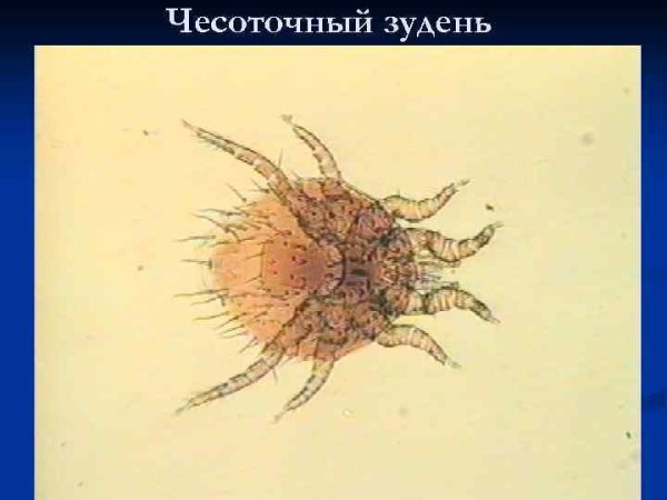 Чесоточный клещ Sarcoptes scabiei