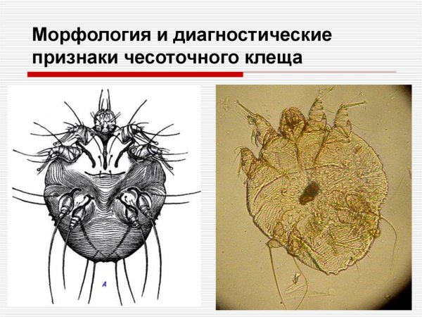 Особенности строения Sarcoptes scabiei