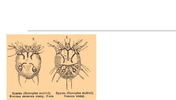Чесоточный зудень и Железница угревая строение