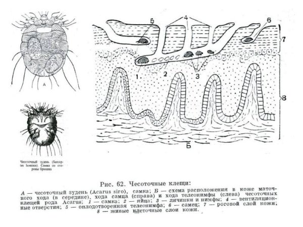 Ходы чесоточного зудня схема