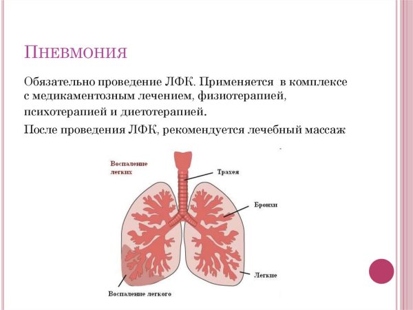 Воспаление лёгких кратко