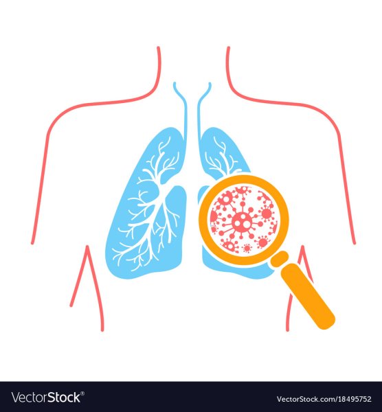 Профилактика легочной пневмонии