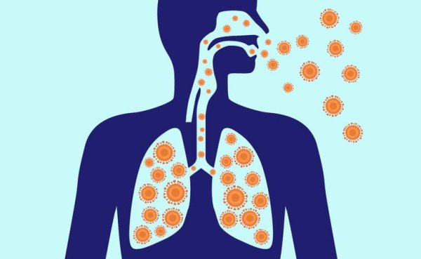 Параканкрозная пневмония