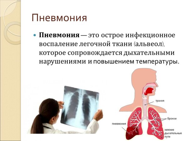 Пневмония иконка