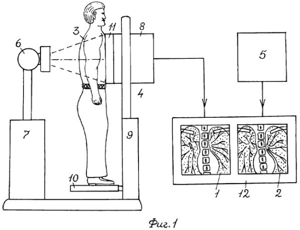 Рентгеновский аппарат рисунок